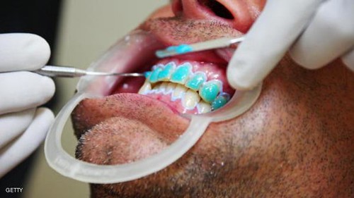 Sitio web de Clínica Dental Sonrisa Plena en Viña del Mar